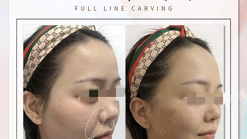 北京正规医美医院对比