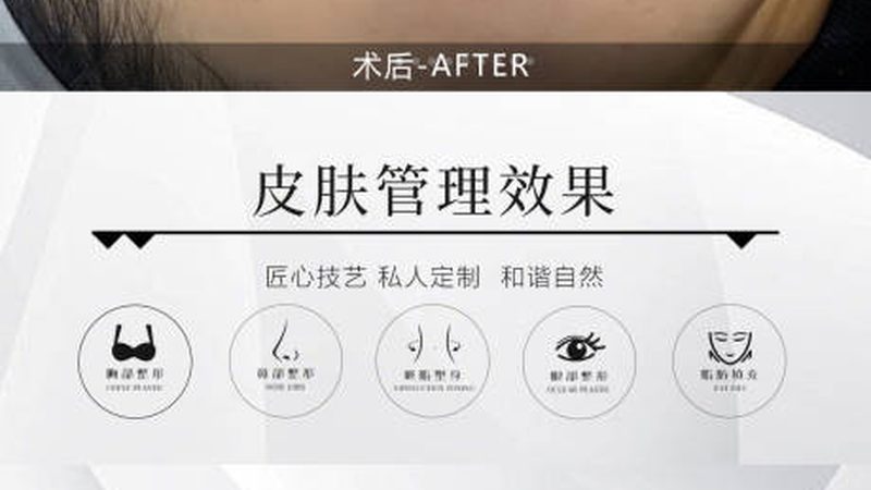 成都热玛吉2025价格解析：揭秘价格背后的秘密
