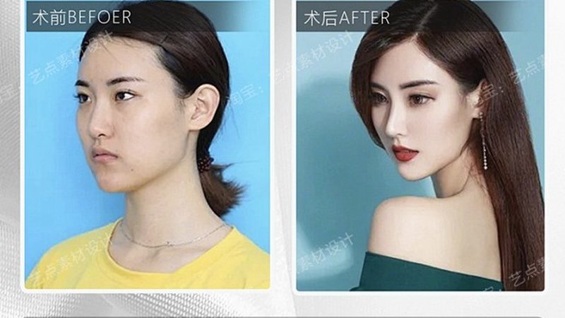 医美咨询师新手入门：流程详解与关键要点