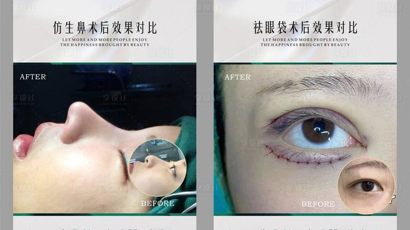 强脉冲光脱毛与光子嫩肤：揭秘两种技术的本质区别