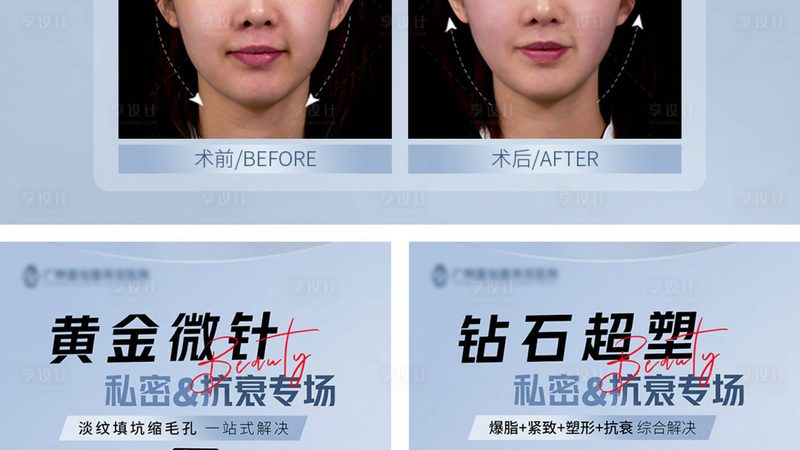 小标题：割双眼皮，常见误区盘点