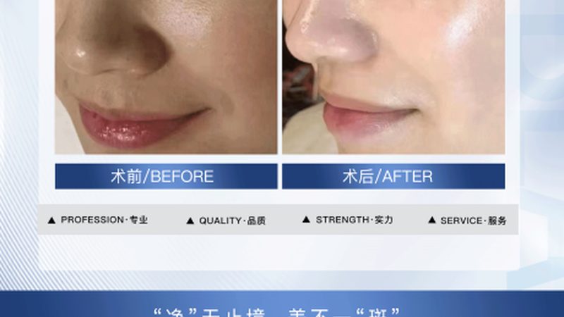 医美手术病历书写规范：确保安全与合规的关键