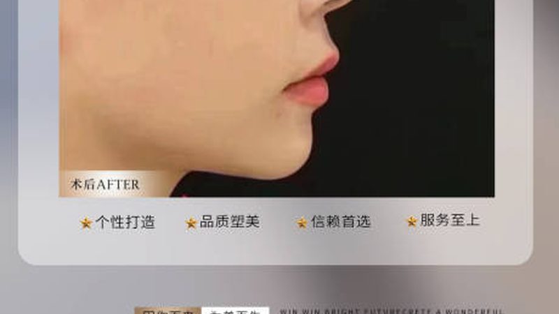 医美面膜与普通面膜：揭秘两者差异，选择更明智