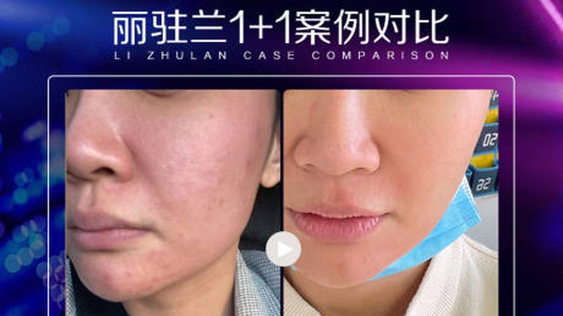 无锡整形医院正畸科：揭秘牙齿矫正的科学之路