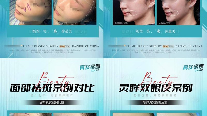 热玛吉设备厂家资质查询