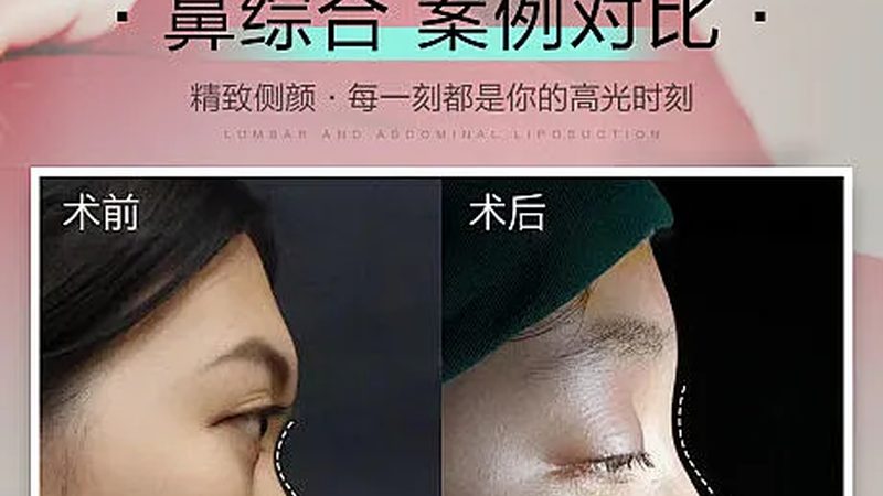 成都医美代理公司排名：揭秘选择优质合作伙伴的关键
