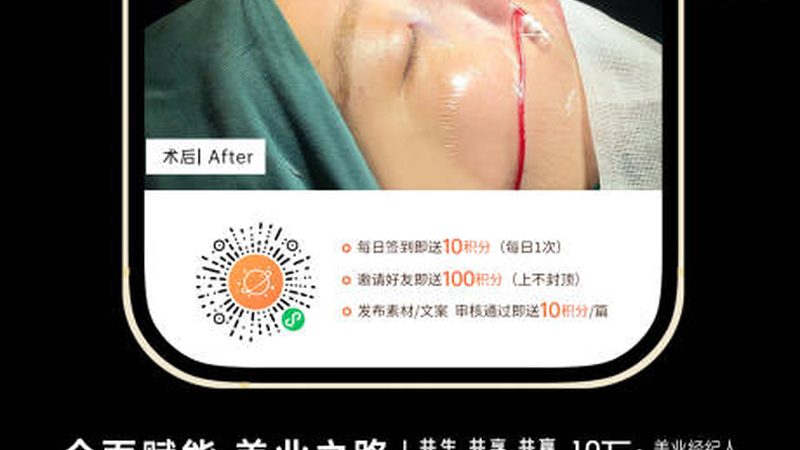 肉毒素：阻断神经，放松肌肉