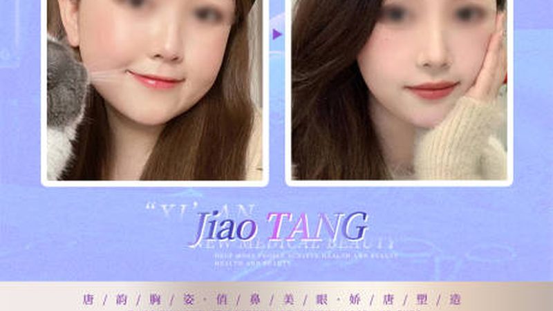 成都割双眼皮恢复期揭秘：了解这些，恢复无忧
