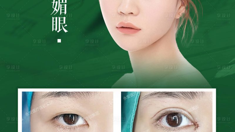 医用激光脱毛机十大品牌排名