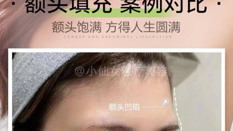广州光子嫩肤团购可以走医保吗