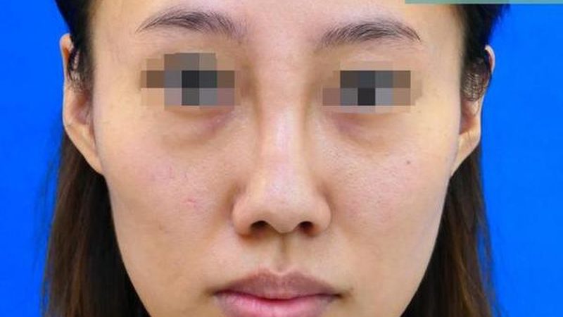 目前，市面上水光针品牌众多，以下列举了进口品牌排名前十的品牌：